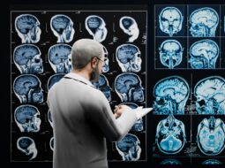 Neurosurgical Innovation