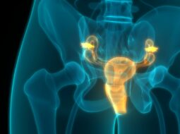 Cervical Disc Replacement